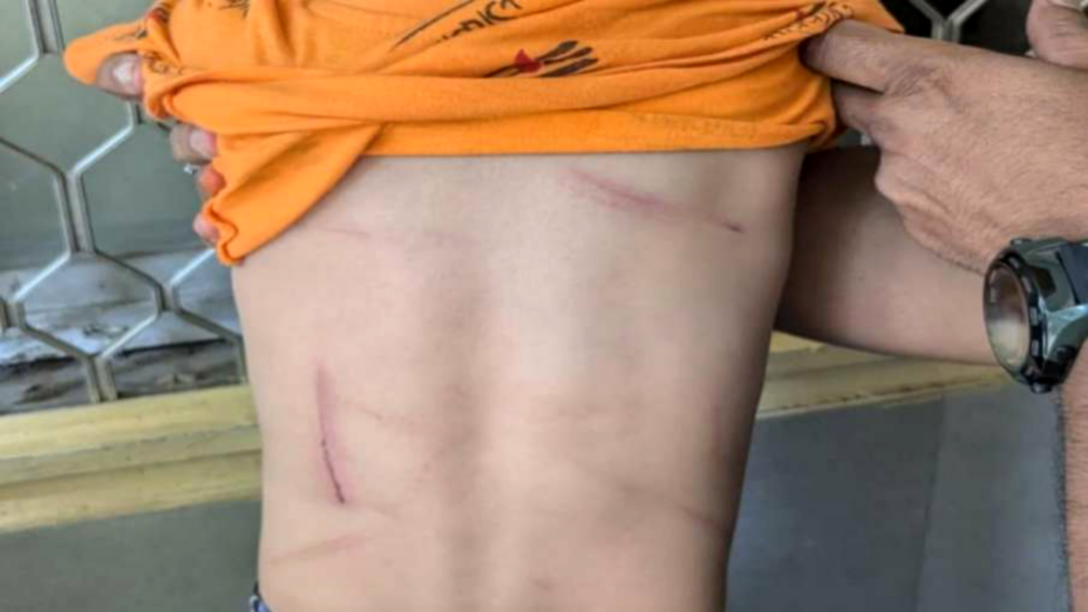 In-Mumbai-a-child-was-burnt-and-beaten-due-to-superstition-police-arrested-the-husband-and-wife-bhandup-news