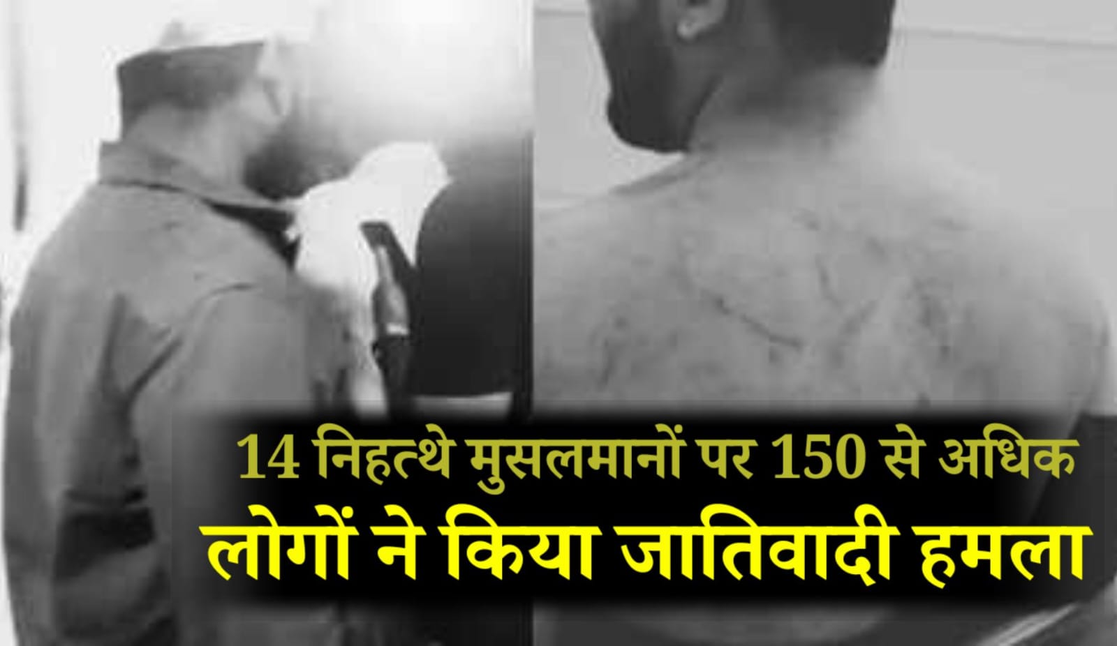 Pune Iftar Attack: Bopdev Ghat के पास इफ्तार कर रहे 14 लोगों पर 150 की भीड़ का हमला, पुलिस जांच शुरू